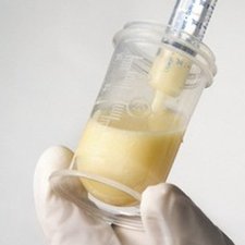 Kolostrum, Tetesan Berharga untuk Sang Bayi