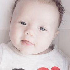 Bayi Berjerawat? Ternyata Bisa Lho Moms!