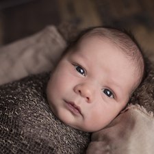 Mengatasi Mata Belek pada Bayi