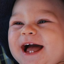 Perlunya Merawat Gigi Bayi