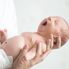5 Kondisi Aneh pada Bayi Baru Lahir