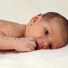 3 Kelainan Kulit Bayi Bersifat Sementara