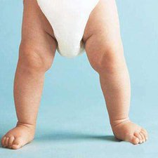 5 Penyebab Kaki Bayi Berbentuk Huruf O