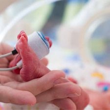 5 Penyebab Bayi Lahir Dengan Berat Badan Rendah