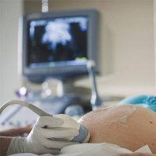 Prenatal Screening yang Dilakukan Oleh Ibu Hamil Sesuai Trimester