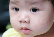Penyebab Biang Keringat pada Bayi