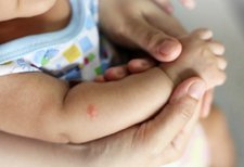 4 Tips Melindungi Bayi dari Gigitan Nyamuk